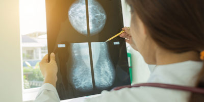 mammografi-lakare-cancer