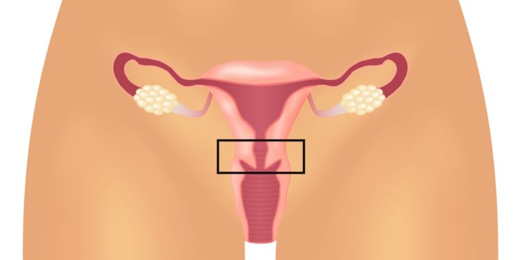 Animerad bild av en kvinnas reproduktionsorgan